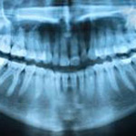 Numeric X-rays in Dental Clinic Fortin Poirier Laval